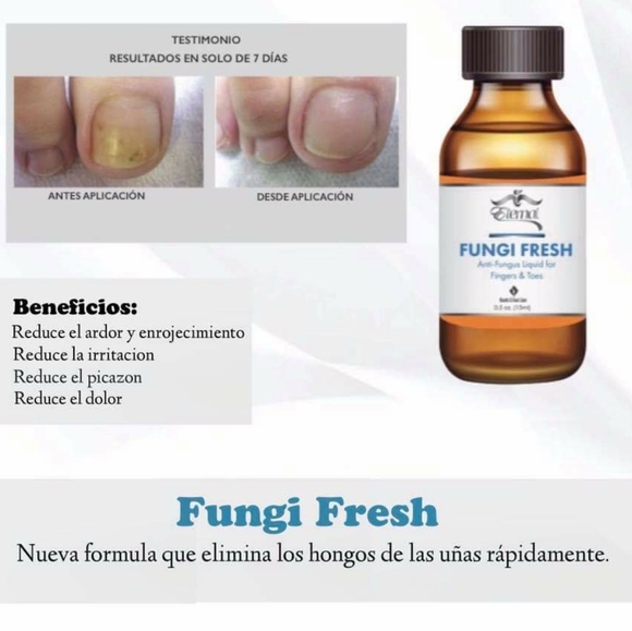 Fungi Freh/ Anti-Fungus EternalSpiritBeauty - Picture 9 of 10